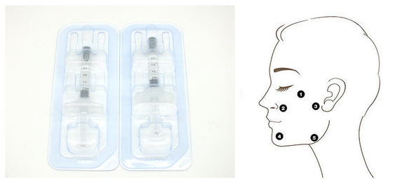 Hyaluronic όξινος ενισχυτής δερμάτων 2ml H+L 32mg/Ml για την του προσώπου αντι γήρανση ανύψωσης