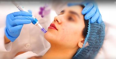 20mg/Ml μη διαγώνιο συνδεμένο δερμικό υλικό πληρώσεως εκταρίου αντι-που γερνά το εκτάριο για τη μάνδρα Hyaluron