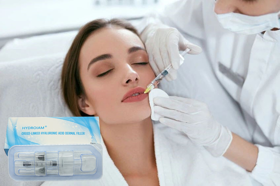 1ml υλικό πληρώσεως Hyaluronic όξινο 24mg/Ml στηθών για το Nasolabial σώμα αυλακιών ρυτίδων