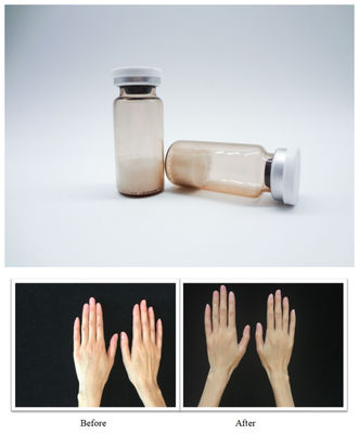 Αποστειρωμένα δερματικά γεμιστικά προσώπου PLLA Υαλουρονικό οξύ Ενέσιμο τζελ σχεδιασμένο για την ομαλή διόρθωση ρυτίδων και την αποκατάσταση του όγκου του προσώπου