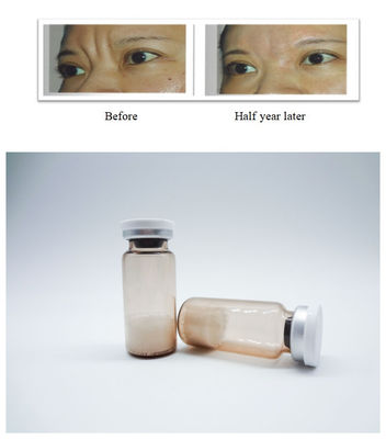 Βιοσυμβατό ενέσιμο PLLA Filler Dermal Filler για μακροχρόνια αποκατάσταση όγκου προσώπου και διόρθωση ρυτίδων
